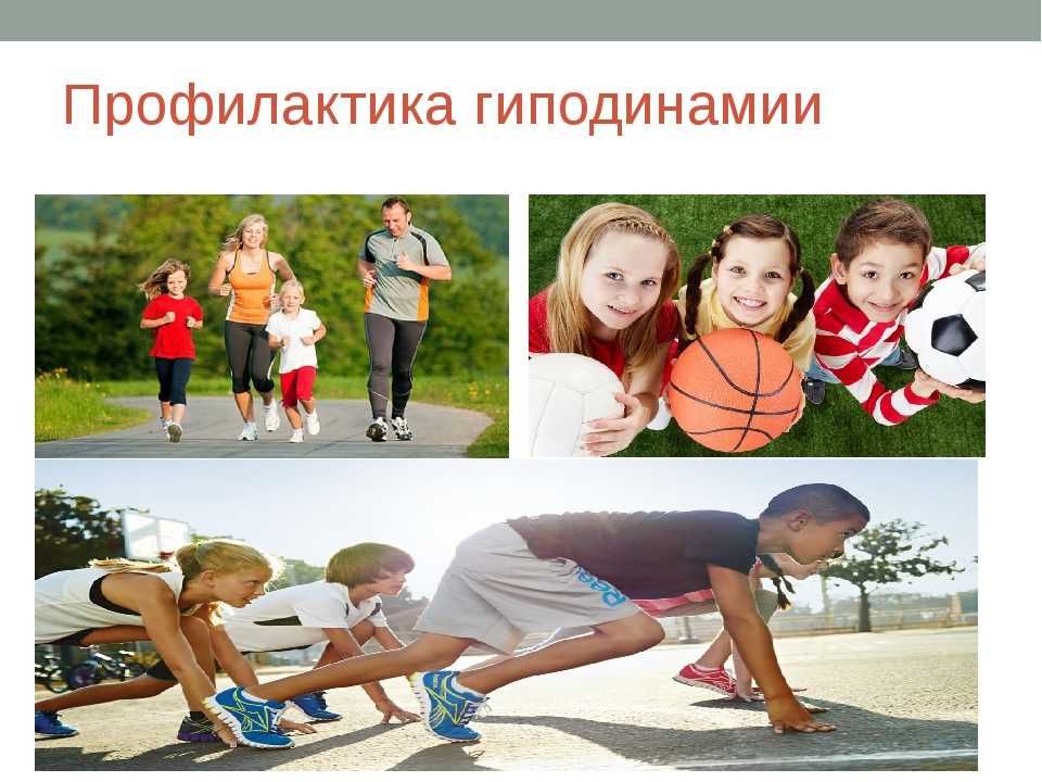 Гиподинамия